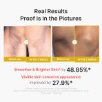 Kojic Acid Turmeric Body Peel Shot - Image 3