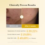 Kojic Acid Tumeric Toner Pad - Image 4