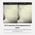 Pore Care Duo - Image 10