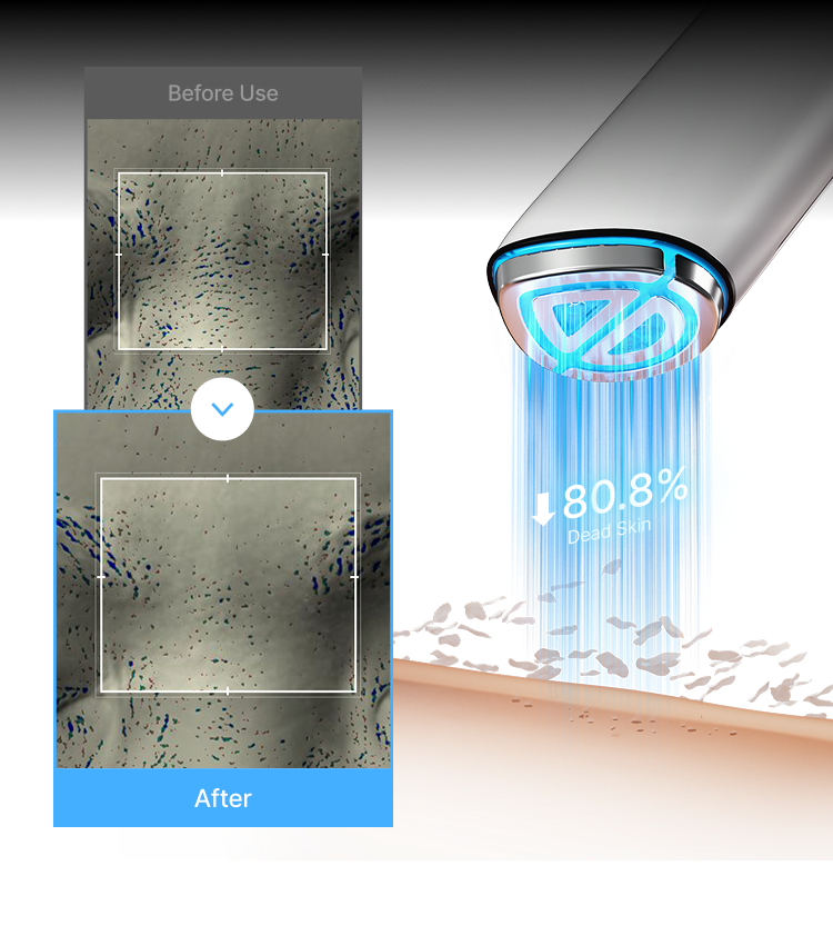 2X Pore Refining clinical results